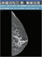 Mammogram image: suffix -gram means picture; record