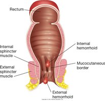 Location of internal and external hemorrhoids
