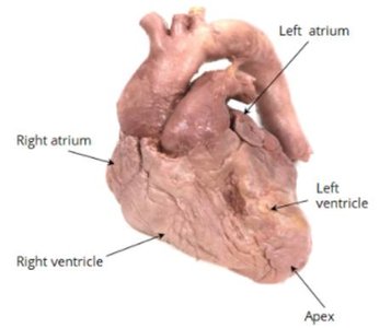 Cadaveric image of heart chambers