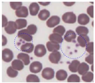 Platelets in a blood smear