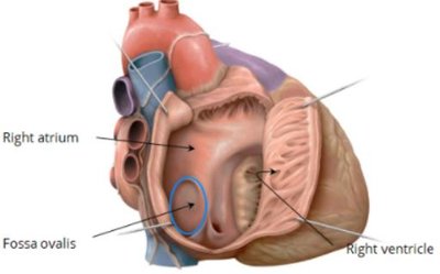 Fossa ovalis