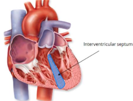 Interventricular septum in cadaveric heart