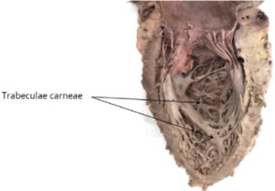 Papillary muscles
