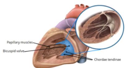 Bicuspid valve in cadaveric heart