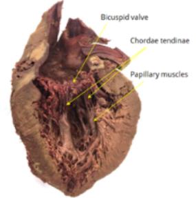 Heart valves cross-section