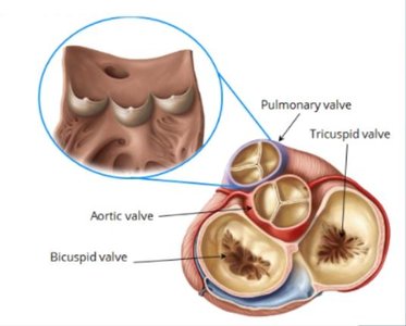 Echocardiogram showing valves and chambers
