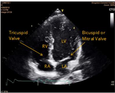 Great vessels draining blood into the heart