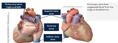 Great vessels pumping blood away from the heart