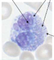 Eosinophil in blood smear