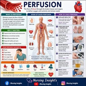 Perfusion overview infographic