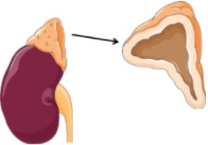 Adrenal gland (target of ACTH)