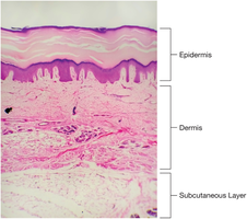 Photomicrograph showing epidermis, dermis, and subcutaneous layer