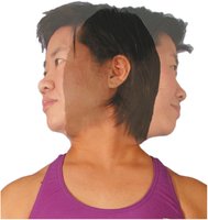 Rotation of the head