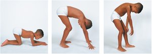 Muscular dystrophy