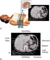 CT scan image of the abdomen