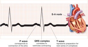 ECG wave record