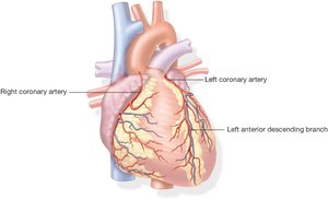 Coronary arteries