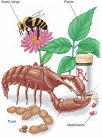 Common causes of allergic reactions: insect stings, plants, food, medications