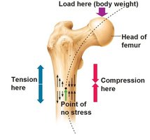 Stress distribution in femur according to Wolff's Law