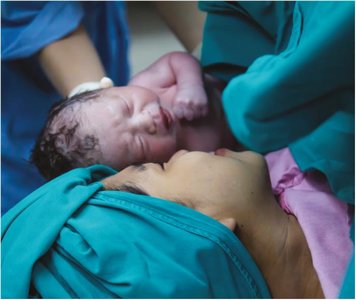 Newborn with cyanosis