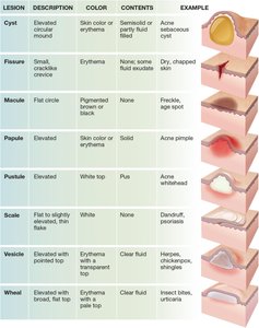 Table of skin lesion types with illustrations