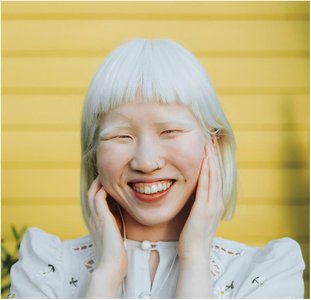 Person with albinism