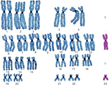 Normal human karyotype with 23 pairs of chromosomes