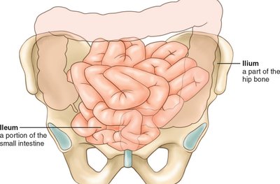 Diagram showing the difference between ileum and ilium