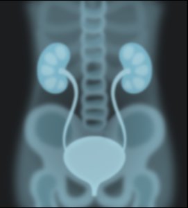 X-ray of urinary system for retrograde pyelography