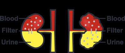 Filtration diagram for eGFR