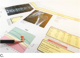Bone densitometry report with risk assessment