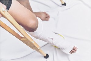 Patient with cast and crutches