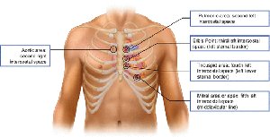 Auscultatory Areas of the Heart