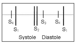 S3 and S4 Heart Sounds