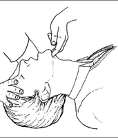 Head tilt, chin lift maneuver