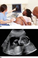 Obstetrical sonography and fetometry