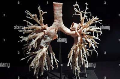 Bronchial tree anatomical model