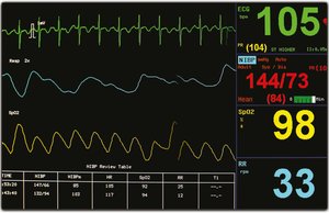 Monitor showing tachypnea