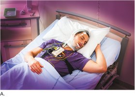 Patient undergoing sleep study