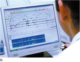 Technician monitoring sleep study data