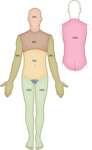 Rule of Nines diagram for burn assessment