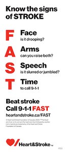 FAST Stroke Assessment