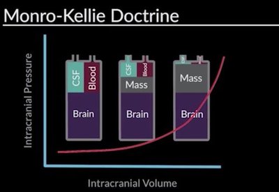 Monro-Kellie Doctrine