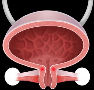 Urinary bladder sphincters