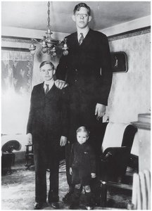 Gigantism: extreme height