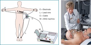 Diagram and photo of EKG setup