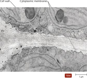 TEM of a eukaryotic cell wall and cytoplasmic membranes