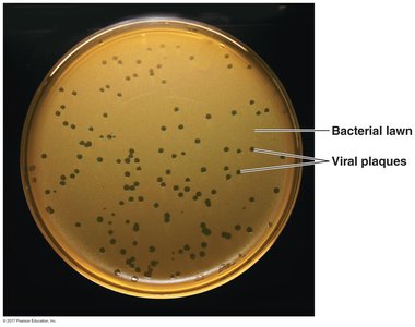 Petri dish showing bacterial lawn and viral plaques