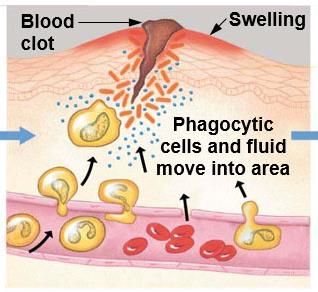Phagocytic cells and fluid moving into inflamed area