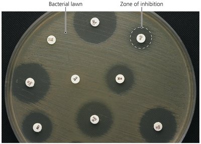 Kirby-Bauer diffusion susceptibility test